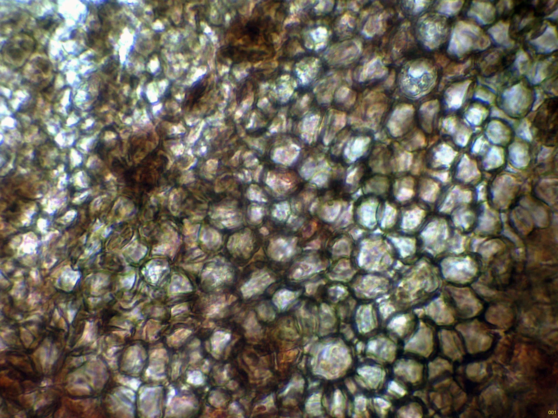 Microscopía de Pyrenopeziza nervicola - 10 - Excípulo